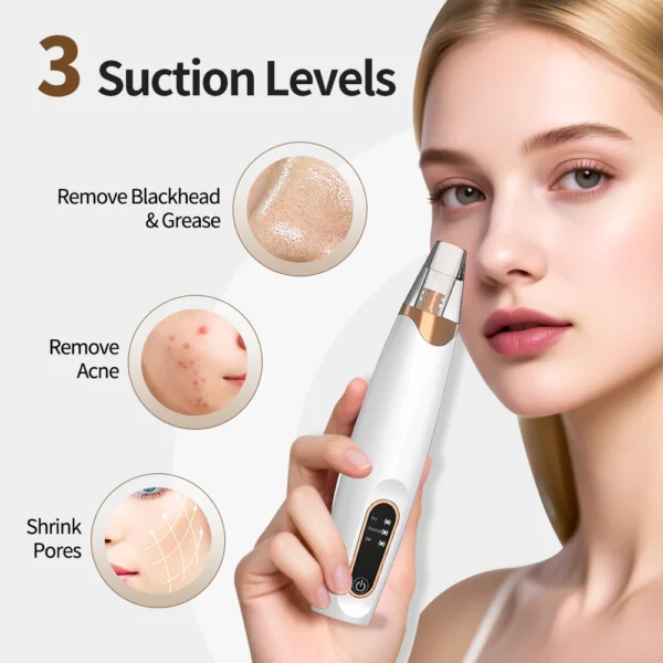 usb rechargeable electric blackhead remover vacuum face pore cleaner whiteheads black spots pimple acne extractor skin care set